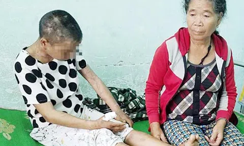 Vụ người làm thuê bị tra tấn dã man ở Gia Lai: Chờ kết quả giám định để khởi tố